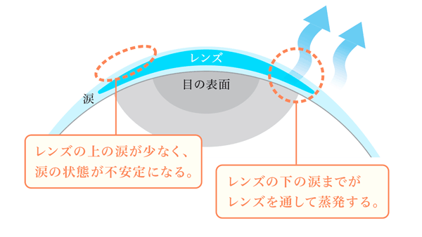 涙とコンタクトレンズの関係