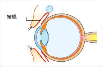 アレルギー性結膜炎 ウィルス性結膜炎 クラミジア結膜炎の治療なら福岡のオガタ眼科クリニック