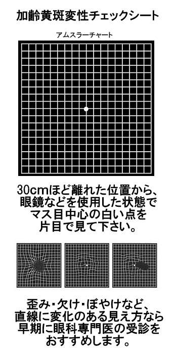 アムスラーチャート　網膜症　黄斑変性