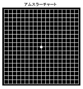 黄斑変性　網膜症　緑内障　チャート